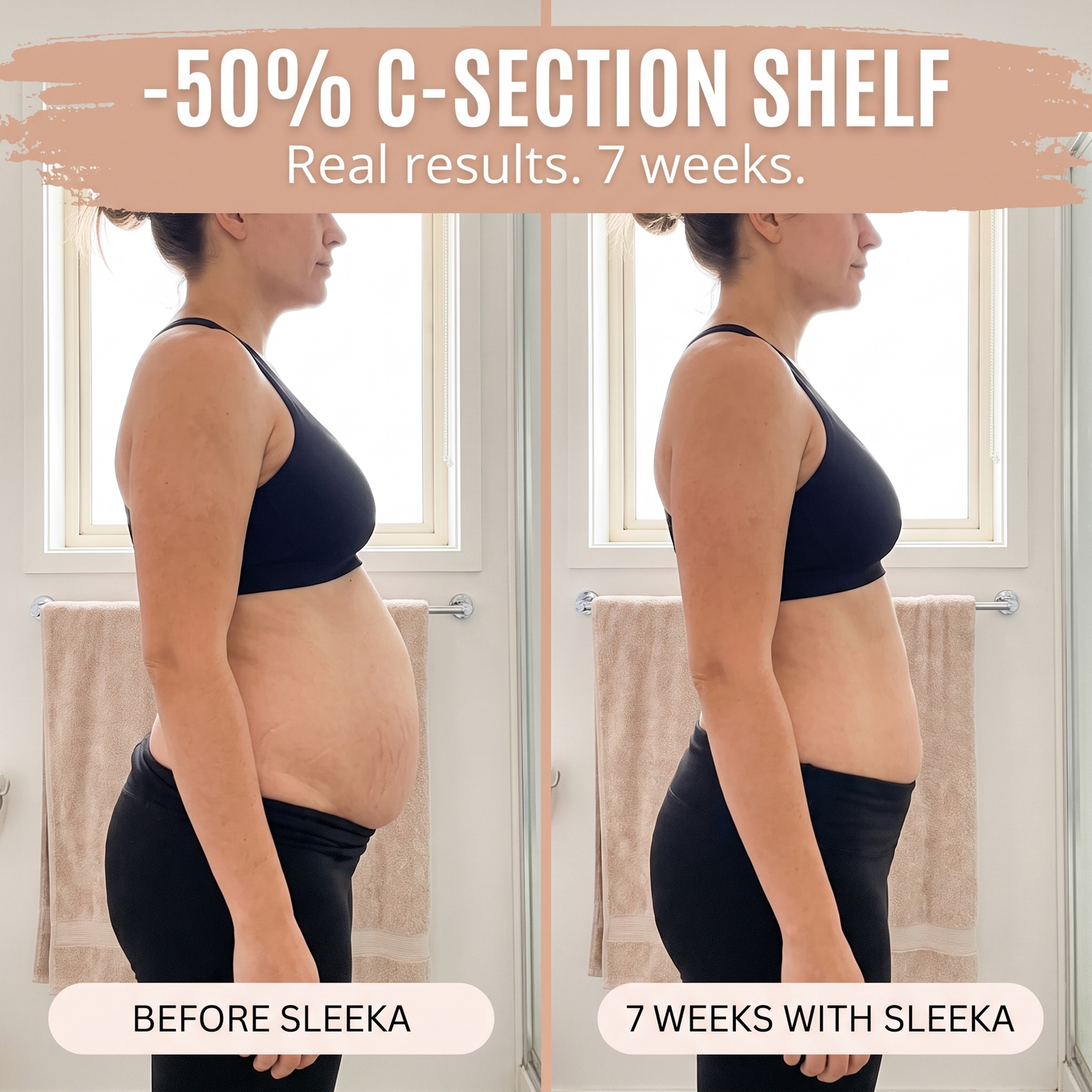 Postpartum Recovery Brief — 360° Compression