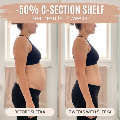 Postpartum Recovery Brief — 360° Compression